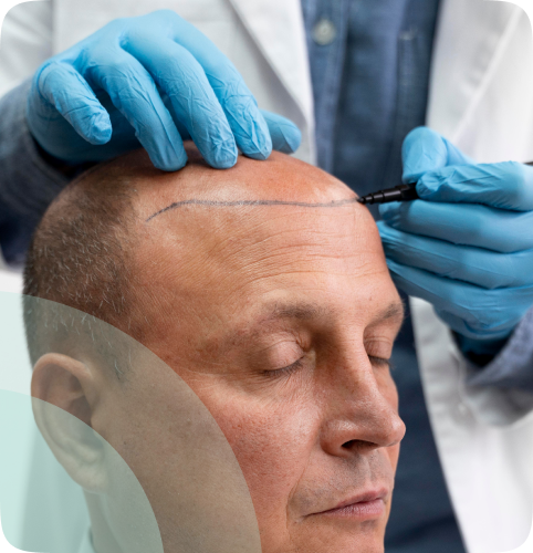 Hair Tree Expert Surgeon